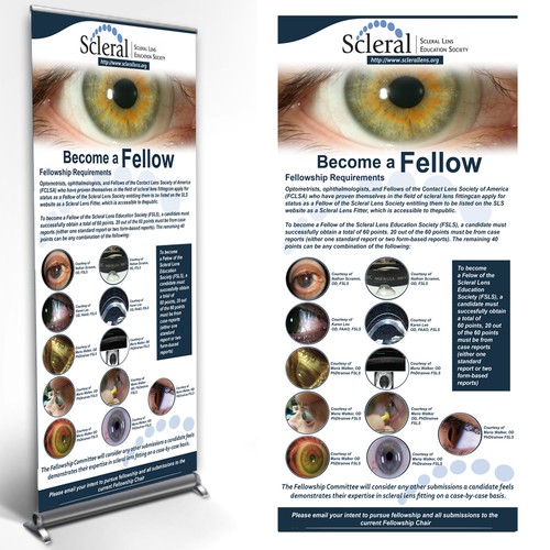 Scleral Poster 