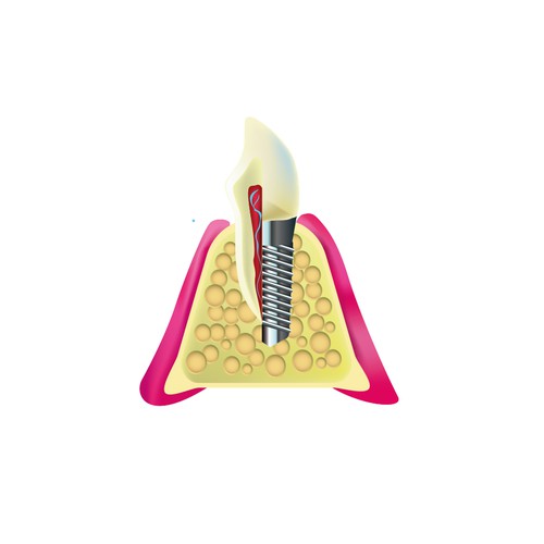 Dental Illustration