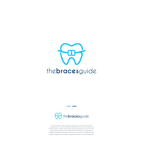 The Braces Guide