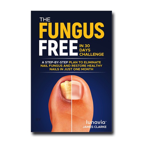 The Fungus-Free in 30 Days Challenge