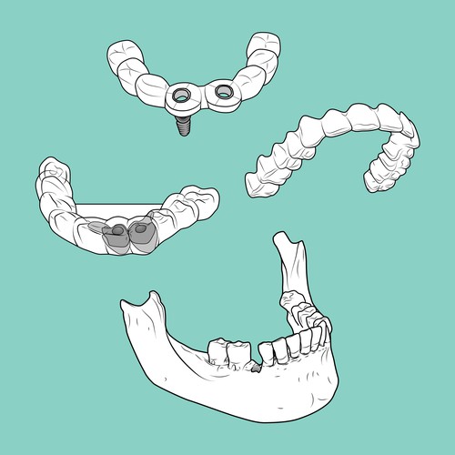 Dental Illustration