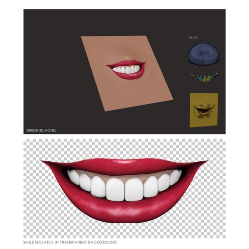 Smile design