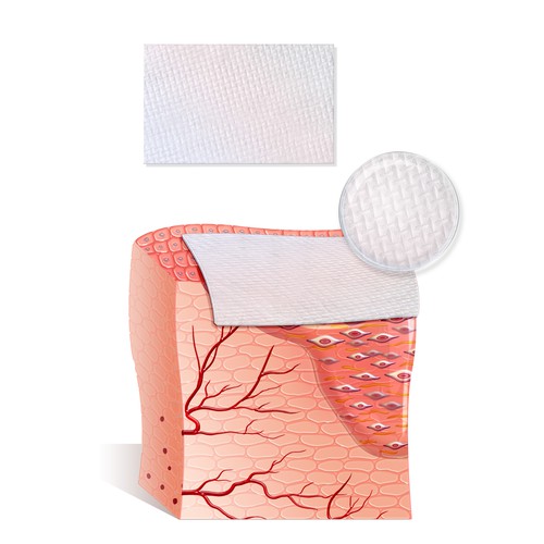 Tissue with EPICORD