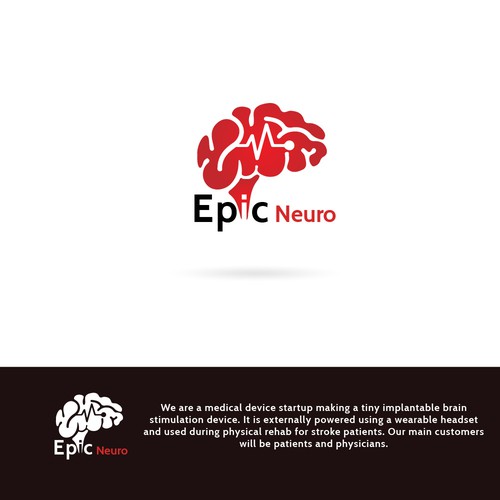 epic neuro