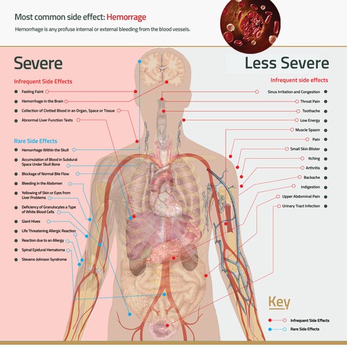 Infographic concept for xarelto