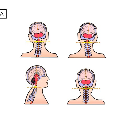 Spinal balance