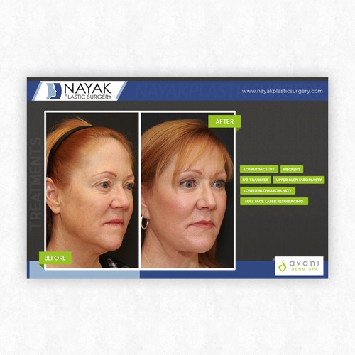 Powerful Before and After Photos for the Nose Ninja