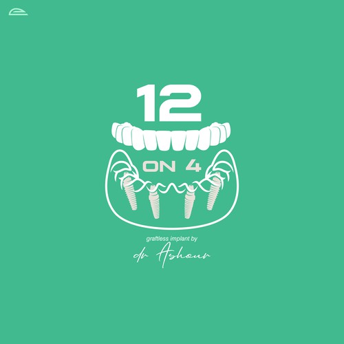 12 ON 4 Dental Implant Logo