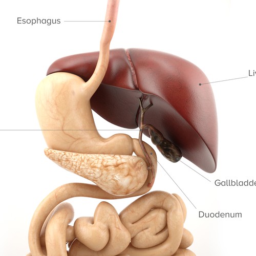 3D Biliary Obstruction