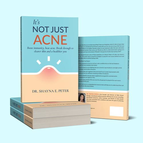 It's Not Just ACNE