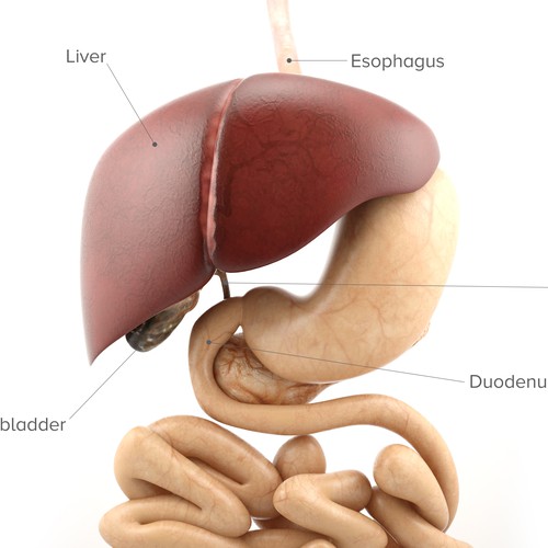 3D Biliary Obstruction