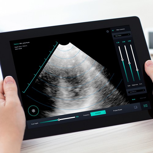 Teleosonic Ultrasound App UI UX Design for the Next Generation of Ultrasound Technology