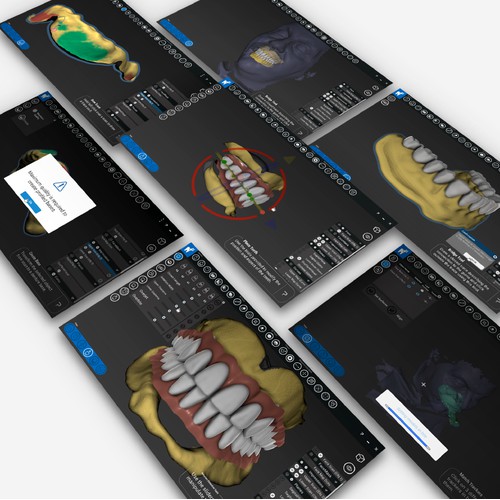 UI Design for Dental 3D Modeling Software