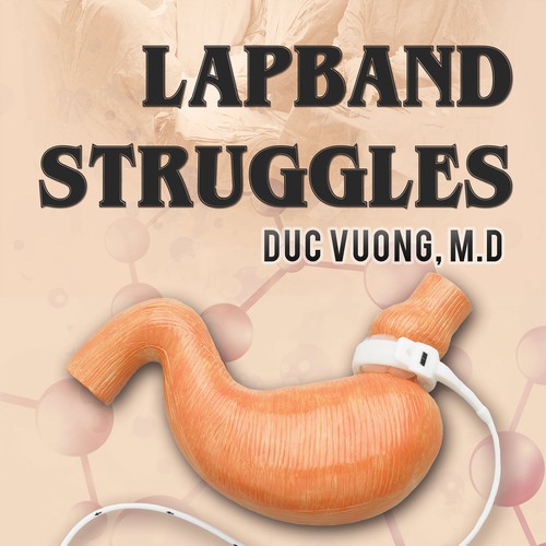 book cover for a  wait loss surgery