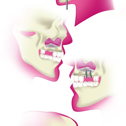 Dental Illustration