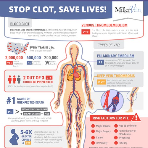 Finalist: Infographic Concept for Miller Vein: Stop Clot, Save Lives!