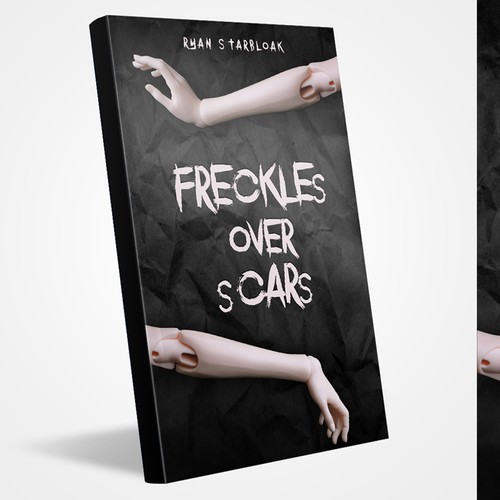 "Freckles Over Scars" book cover